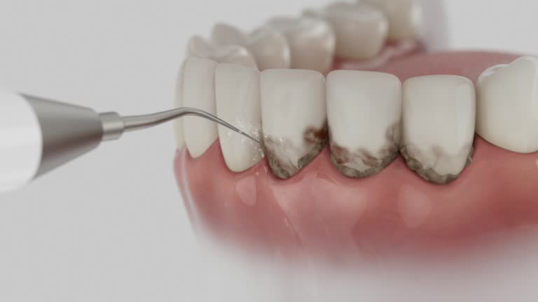 Trusted Root Canal Treatment service in Springfield, FL - Dentist Open Now